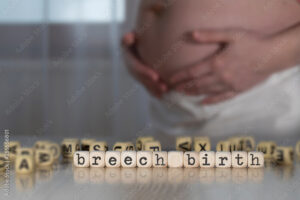 Breech presentation Seattle WA