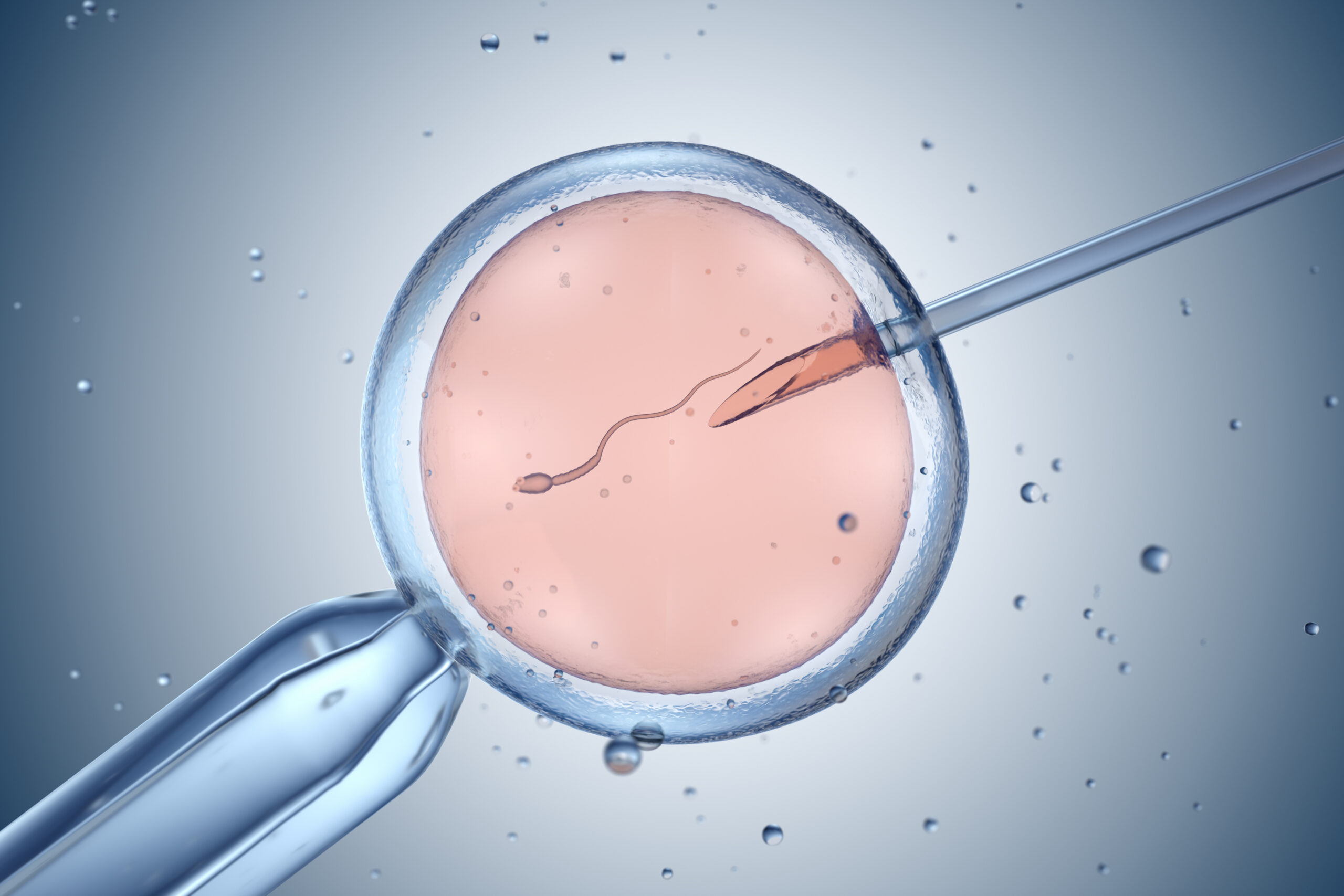 Image of ICSI IVF