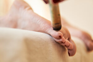 Treatment of moxibustion. Herbal therapy used by a professional eastern medicine practitioner to warm foot toe energy point